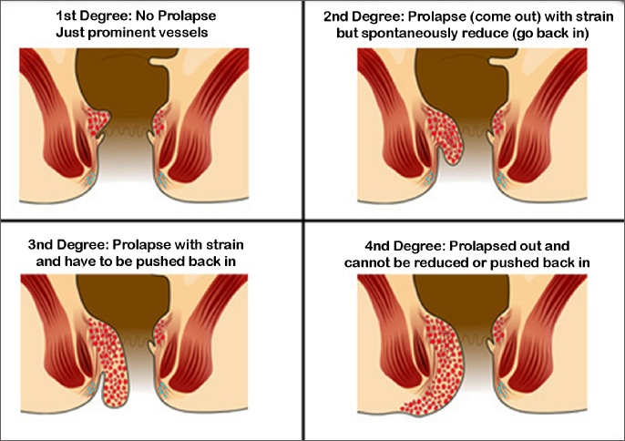 Taps recommends best of Thrust deep anus agony anus Thrust agony deep