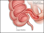 Terminal ileum