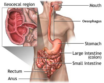 Areas of the gut affected by Crohn's disease