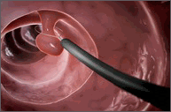 Colonoscope for performing colonoscopy