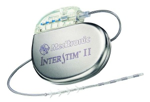 Medtronic SNS Stimulator