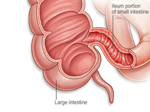 Terminal ileum