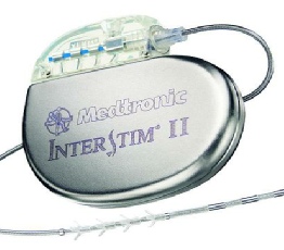 Medtronic Interstim for Sacral Nerve Stimulation for Faecal Incontinence